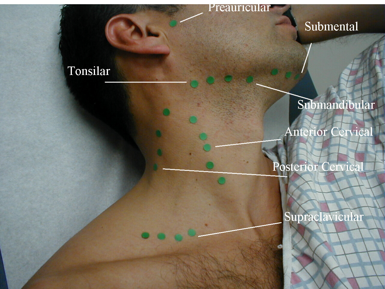 head_lymphnodes2