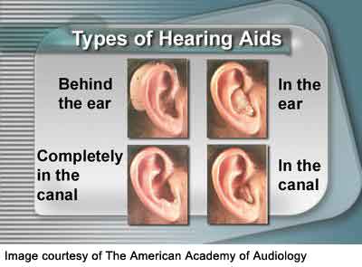 hearingaidtypes