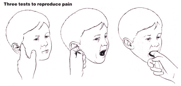Заложено ухо после простуды но не болит. Гимнастика при закладывании ушей. Упражнение чтобы разложило ухо. Упражнения для раскладывания ушей. Упражнения от заложенности в ушах при насморке.