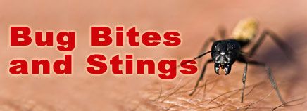 Bug_bites_stings