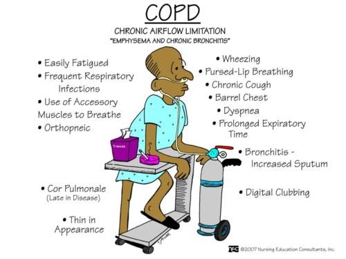 copd sx