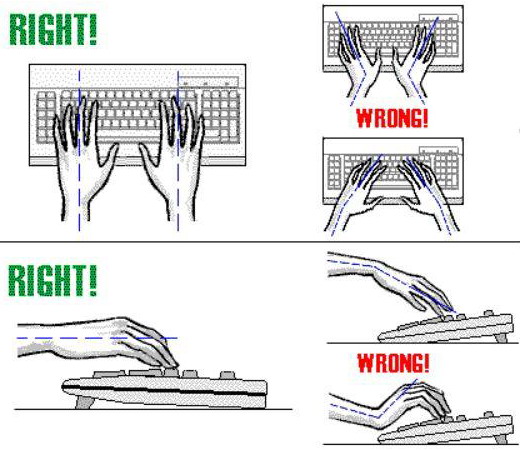 carpal tunnel syndrome keyboard