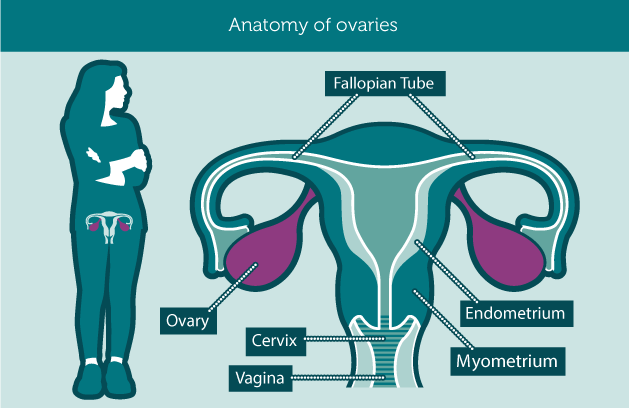 ovarian cancer anatomy