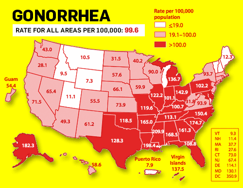 gonorrhea stat