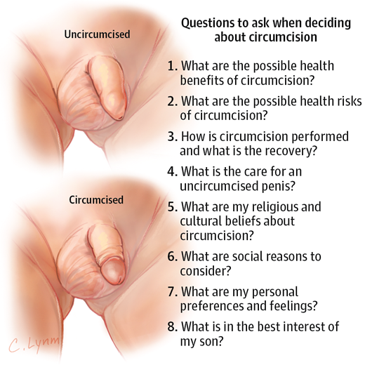 circumcision questions