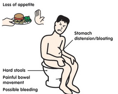 Constipation-Symptoms-and-Signs