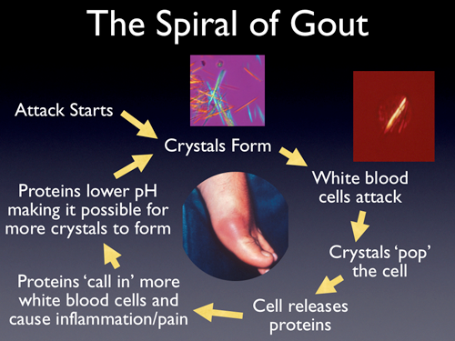 gout-spiral